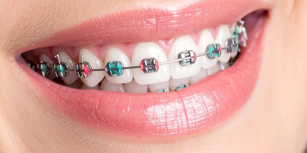 Crowns and bridges in lucknow, Best dentures in lucknow, Best maxillofacial surgeon in lucknow, Best dentist in Lucknow,  dentist in Lucknow