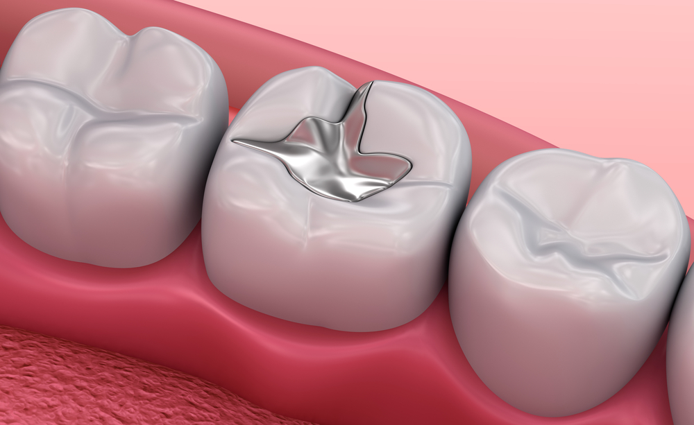 Crowns and bridges in lucknow, Best dentures in lucknow, Best maxillofacial surgeon in lucknow, Best dentist in Lucknow,  dentist in Lucknow